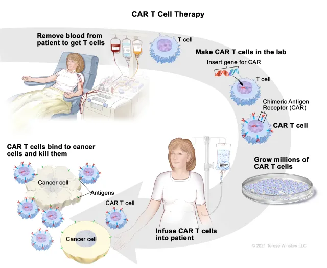 CAR T Cell Therapy | Cancer Support Community